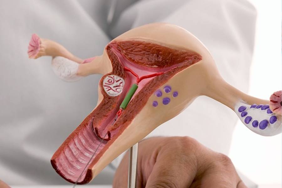 IUI Treatment Center in Rewari